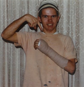 #526=Elliott's broken hand; Feb. 1974